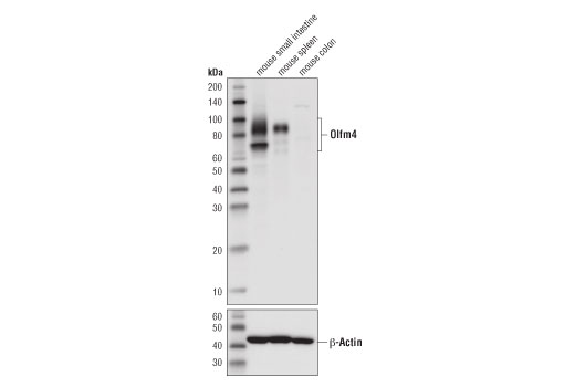 マウス小腸 (ポジティブ)、マウス脾臓 (ポジティブ)、およびマウス小腸 (ネガティブ) からの抽出物を、Olfm4 (D6Y5A) (上) およびβ-Actin (D6A8) (下)  を用いてウェスタンブロッティングで解析しました。