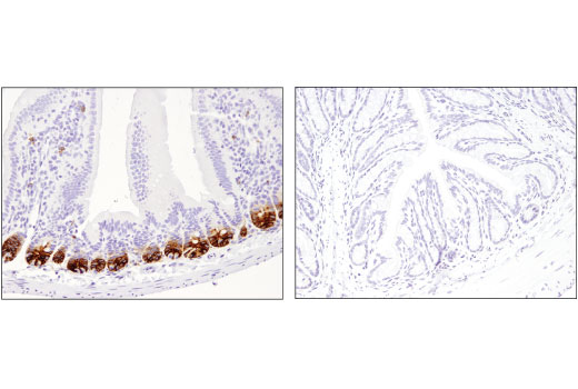 パラフィン包埋正常マウス小腸 (左) および大腸 (右) を、Olfm4 (D6Y5A) を用いて免疫組織化学染色で解析しました。