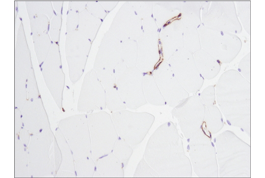 パラフィン包埋したマウス骨格筋を、α-SmoothMuscle Acting (D4K9N) を用いて免疫組織化学染色で解析しました。予測されたように、血管平滑筋細胞が染色され、平滑筋アクチンの発現の無い筋細胞は染色されないことに注意してください。
