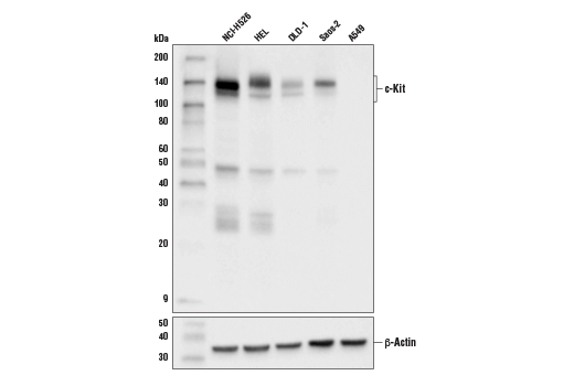 Western Blotting