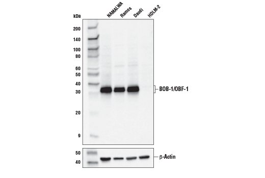 Western Blotting