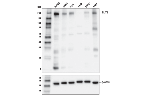 Western Blotting
