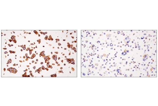 パラフィン包埋RT4細胞ペレット (左、高発現) およびHDLM-2細胞ペレット (右、低発現) を、Nectin-2/CD112 (D8D3F) を用いて免疫組織化学染色で解析しました。