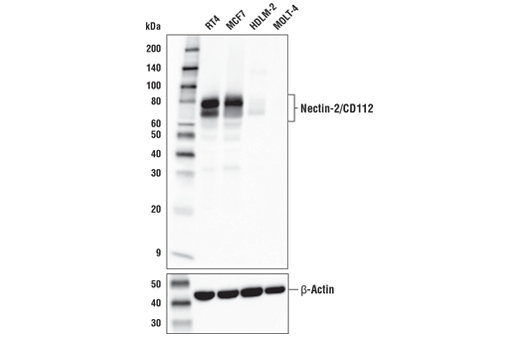 多様なヒト細胞からの抽出物を、Nectin-2/CD112 (D8D3F) (上) およびβ-Actin (D6A8) (下) を用いてウェスタンブロッティングで解析しました。