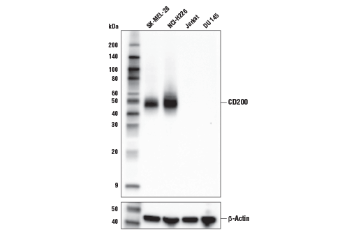 多様な細胞株からの抽出物を、CD200 (E5I9V) (上) またはβ-Actin (D6A8) (下) を用いてWBで解析しました。