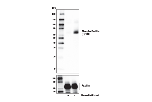 Phospho-Paxillin (Tyr118) (E9U9F) Rabbit mAb (上) およびPaxillin (D9G12) Rabbit mAb #12065 (下) を用いた、未処理 (-) またはフィブロネクチンで被膜したプレート表面への誘導付着 (10 μg/ml,  hr; +) した懸濁HeLa細胞からの抽出物のウェスタンブロット解析。