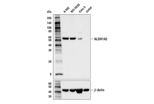 ALDH1A2 (E6O6Q) (上) およびβ-Actin (D6A8) (下) を用いた、各種細胞株からの抽出物のWB解析。細胞株間のALDH1A2の発現レベルは、公表されているバイオインフォマティクスデータベースに基づく予測と一致しています。