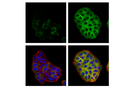Confocal ICC analysis of HT-29 cells, untreated (left) or treated with Aphidicolin (10 μg/ ml, 24 hr; right), using RRM2 (E7Y9J) (green). Actin filaments were labeled with DyLight 554 Phalloidin (red). Samples were mounted in ProLong Gold Antifade Reagent with DAPI (blue).