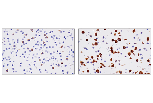 RRM2 (E7Y9J) を用いた、未処理 (左) またはアフィジコリンで処理した (右) パラフィン包埋HT-29細胞ペレットのIHC解析。