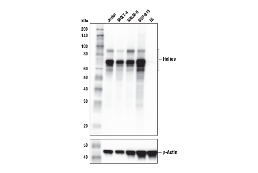 Helios (E4L5U) ラビットモノクローナル抗体 (上) とβ-Actin (D6A8) Rabbit mAb #8457 (下) を用いた、さまざまな細胞株からの抽出物のウェスタンブロット解析。予想通り、Heliosタンパク質はRL細胞で発現がみられません。