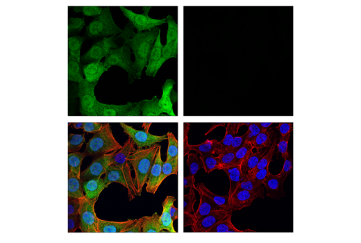 野生型 (左、ポジティブ) またはThymidine Kinase 1ノックアウト (右、ネガティブ) のHCT116細胞を、Thymidine Kinase 1 (E2H7Z) Rabbit mAb (緑) を用いて免疫細胞化学染色し、共焦点顕微鏡で観察しました。アクチンフィラメントは、DyLight554 Phalloidin #13054 (赤) で染色しました。サンプルは、ProLong® Gold Antifade Reagent with DAPI #8961 (青) にマウントされました。