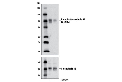 Phospho-Semaphorin 4B (Ser825) 