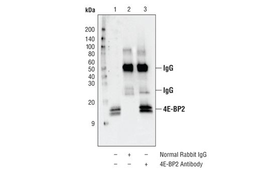 Normal Rabbit IgG 2729 CST normal-rabbit-igg-2729-cst
