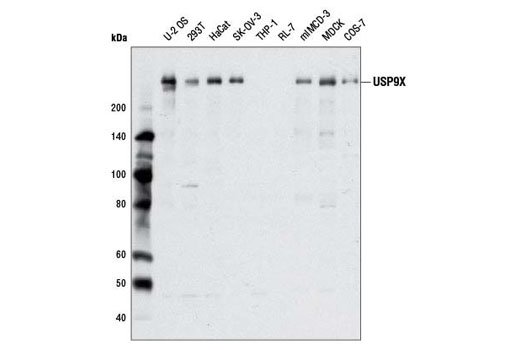 Western Blotting