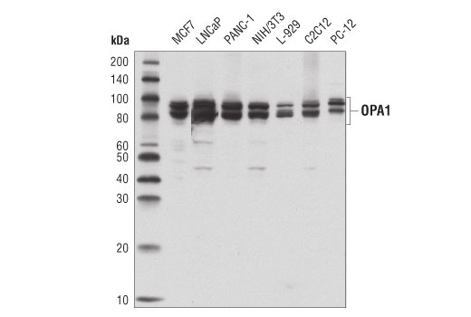 Western Blotting