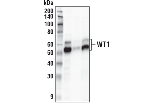 Wt1 Transcription Factor Antibodies 2030