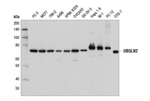 Western Blotting