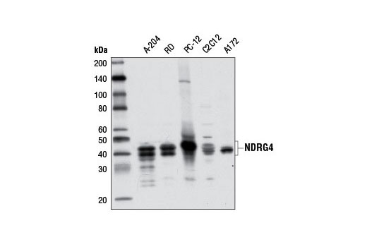 Western Blotting
