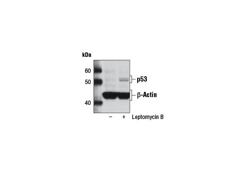 Leptomycin B #9676-Cell Signaling Technology