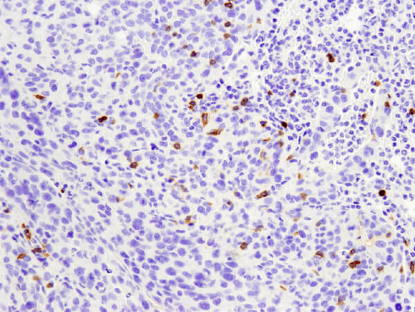 CD4 25229 mouse lung tumor