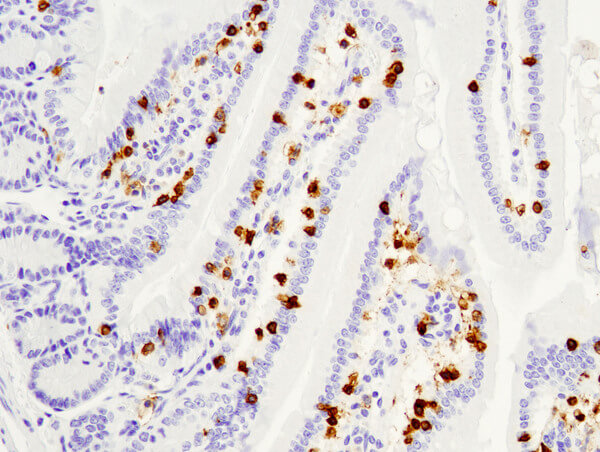 CD8 98941 mouse small intestine
