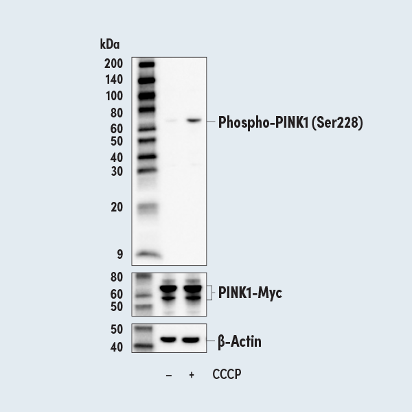 Phospho-PINK1 (Ser228)：PDのミトコンドリア機能障害