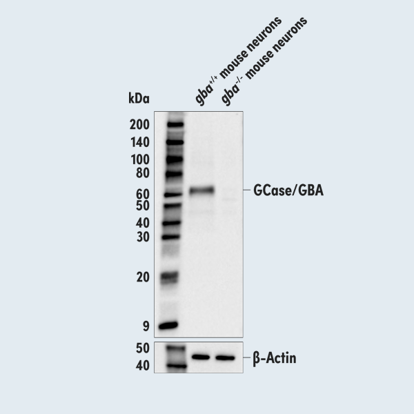 GCase：PDに関連するリソソーム酵素