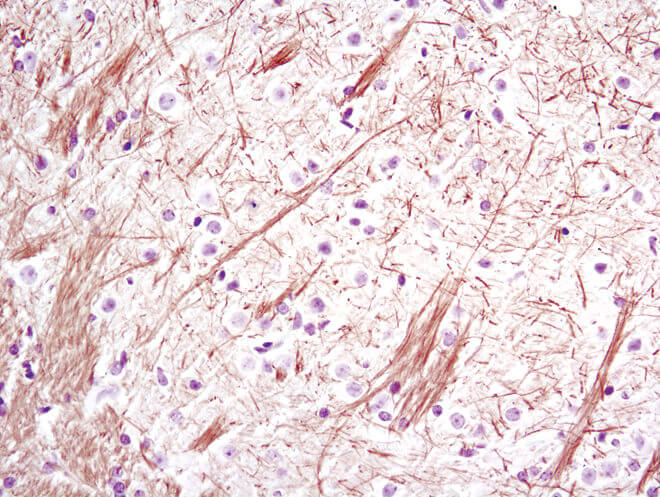 ニューロフィラメント-L免疫組織化学染色