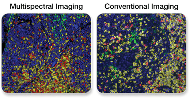IHC multispectral vs conventional