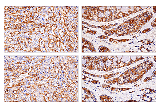 Immunohistochemistry Image 5: APP (E8B3O) Rabbit Monoclonal Antibody (BSA and Azide Free)