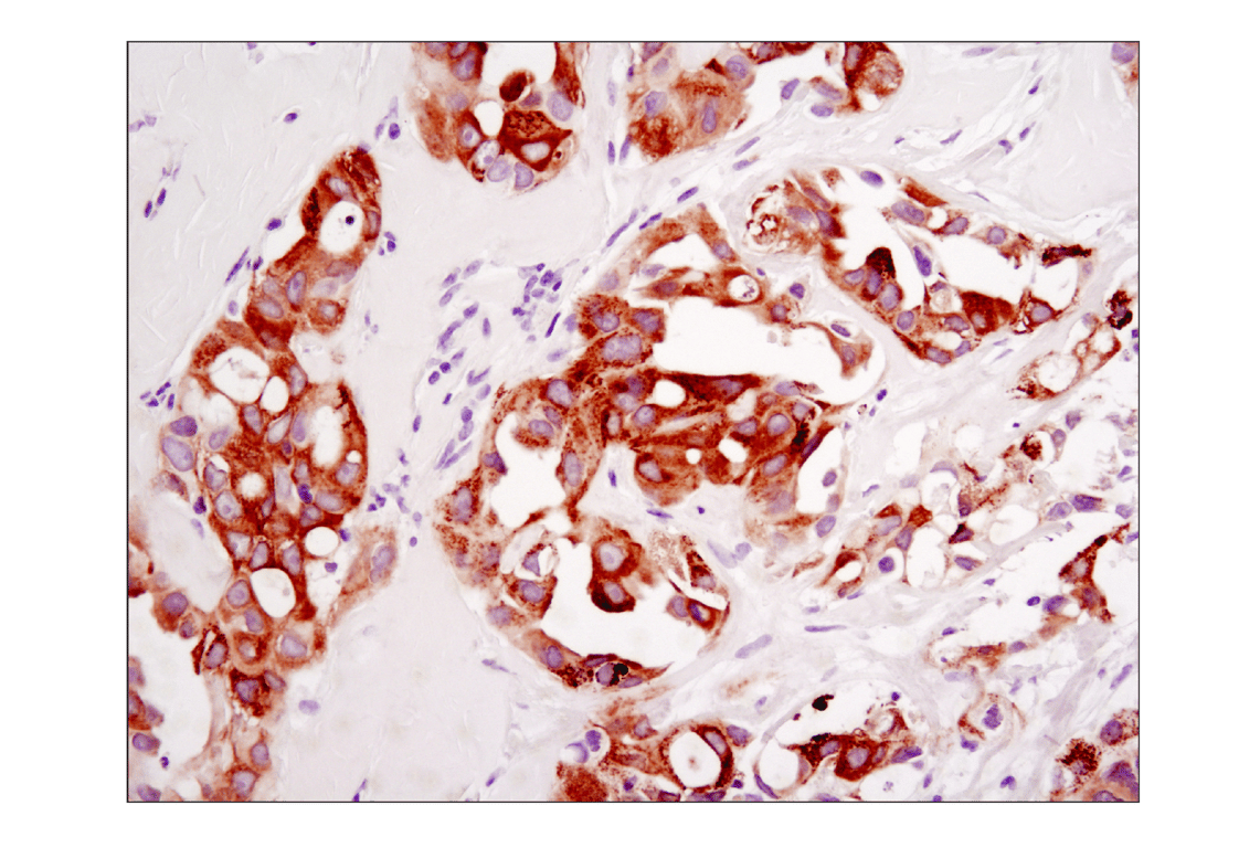 Immunohistochemistry Image 4: ROS1 (D4D6) Rabbit Monoclonal Antibody