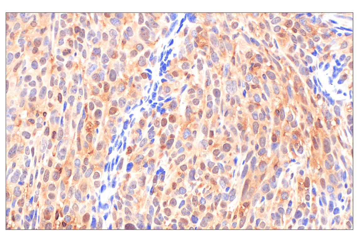 Immunohistochemistry Image 8: Phospho-ATP-Citrate Lyase (Ser455) (F4T8R) Rabbit Monoclonal Antibody