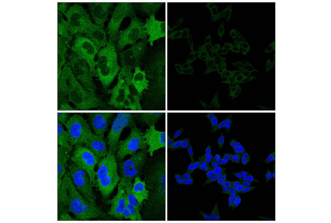Immunofluorescence Image 1: Atg7 (F4V2N) Rabbit Monoclonal Antibody