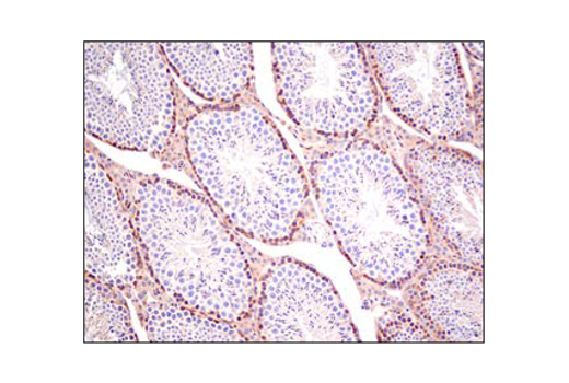 Immunohistochemistry Image 4: PLC gamma1 (D9H10) Rabbit Monoclonal Antibody (BSA and Azide Free)