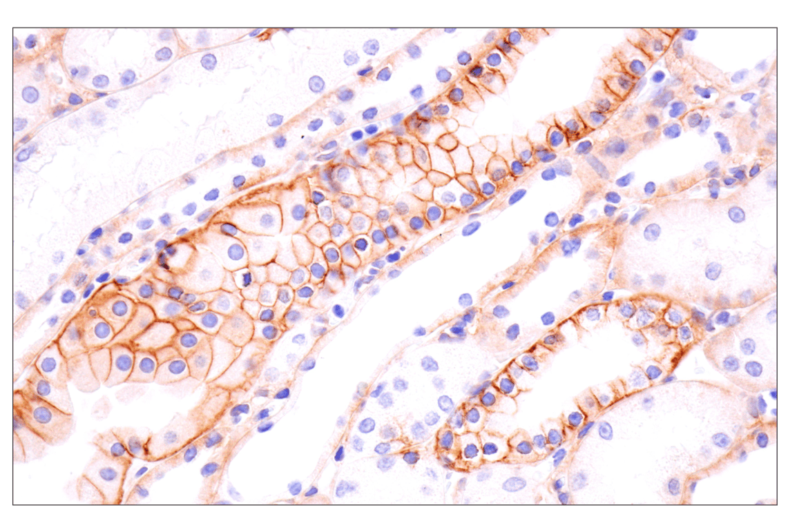 Immunohistochemistry Image 4: EGF Receptor (D38B1) Rabbit Monoclonal Antibody