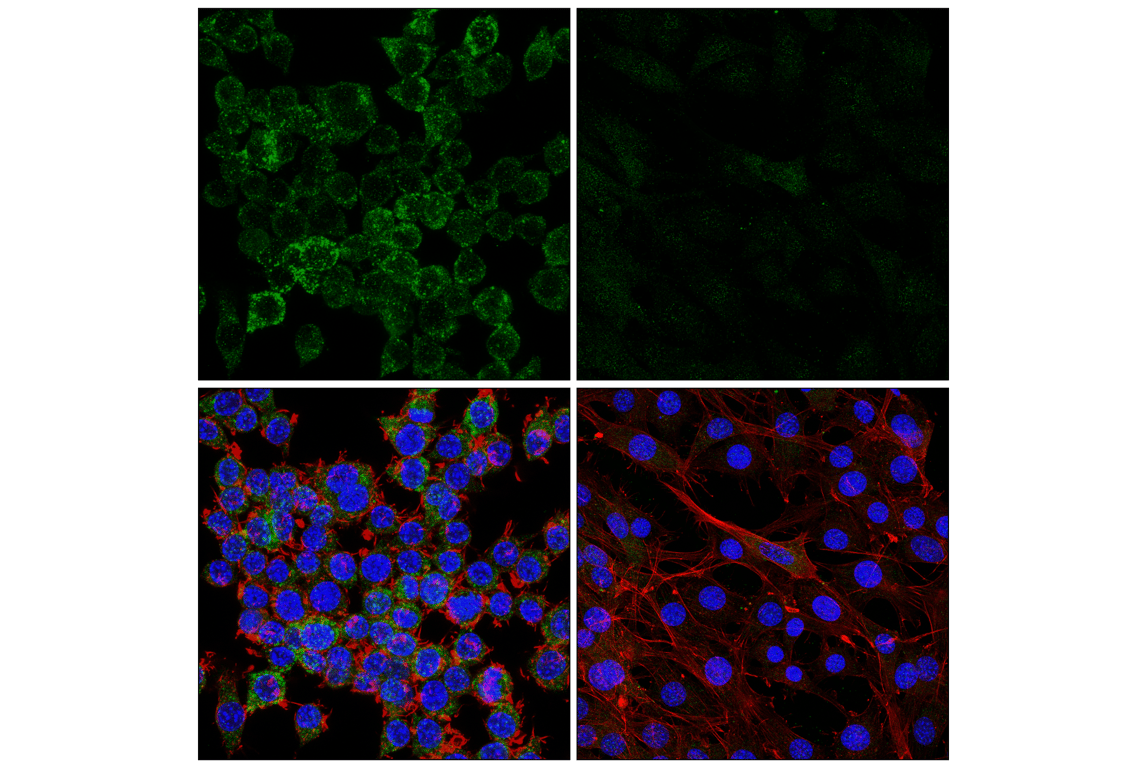 Immunofluorescence Image 1: HEXB (E9X5S) Rabbit Monoclonal Antibody