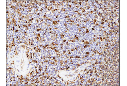 Immunohistochemistry Image 3: CD74 (D5N3I) Rabbit Monoclonal Antibody