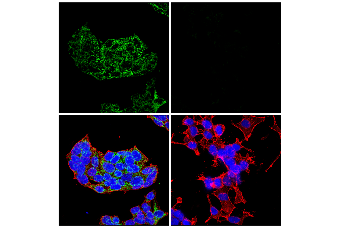 Immunofluorescence Image 1: GOT2 (F4P3R) Rabbit mAb