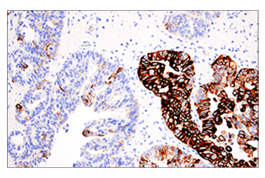 Immunohistochemistry Image 3: Keratin 5 (E2T4B) Rabbit Monoclonal Antibody