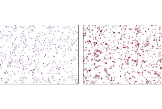 Immunohistochemistry Image 3: Phospho-EGF Receptor (Tyr1173) (53A5) Rabbit Monoclonal Antibody (BSA and Azide Free)