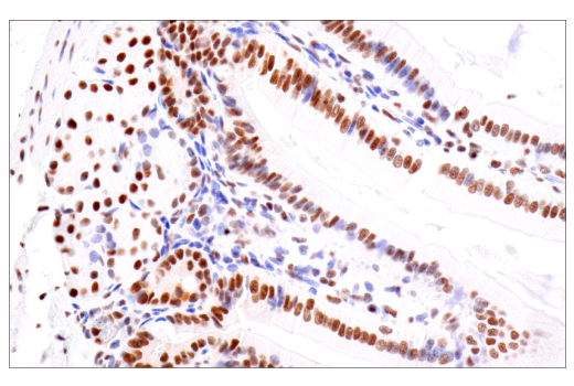 Immunohistochemistry Image 14: CPSF4 (E2L2Z) Rabbit Monoclonal Antibody