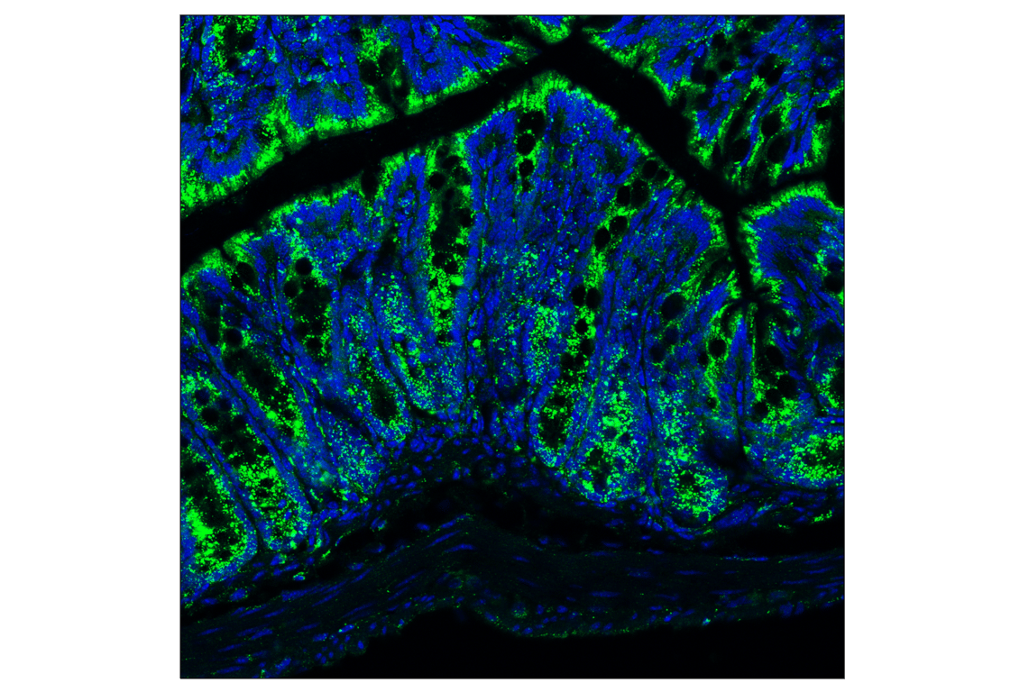 Immunofluorescence Image 1: HEXB (E9X5S) Rabbit Monoclonal Antibody