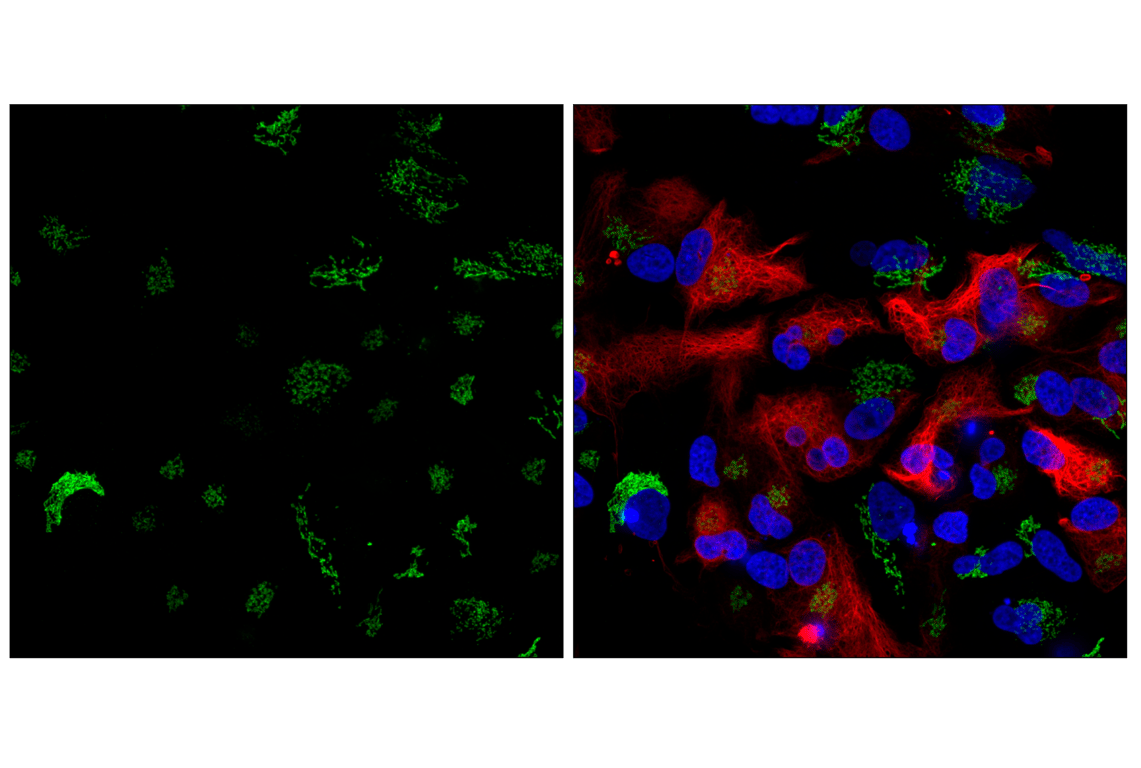 Immunofluorescence Image 3: GM130 (D6B1) Rabbit Monoclonal Antibody