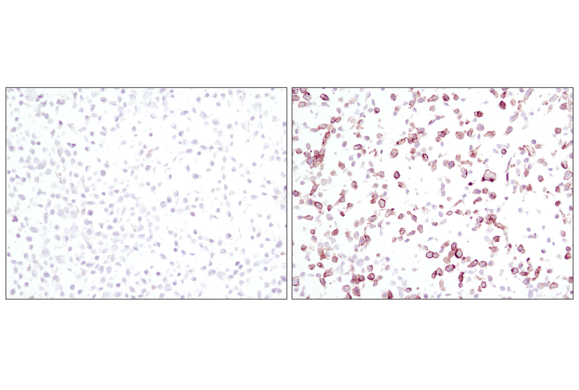 Immunohistochemistry Image 1: Phospho-EGF Receptor (Tyr1068) (D7A5) Rabbit Monoclonal Antibody (BSA and Azide Free)