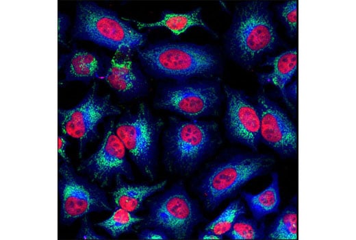 Immunofluorescence Image 1: Survivin (71G4B7) Rabbit mAb (Alexa Fluor<sup>®</sup> 555 Conjugate)