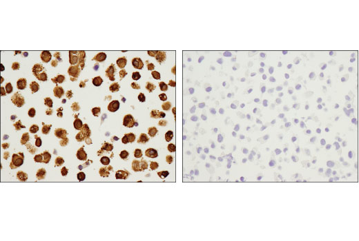 ｃｄ1 Frontiers | The Notch Ligand Jagged1 as a Target for Anti