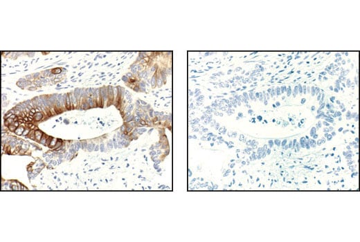Immunohistochemistry Image 3: Phospho-mTOR (Ser2448) (49F9) Rabbit Monoclonal Antibody