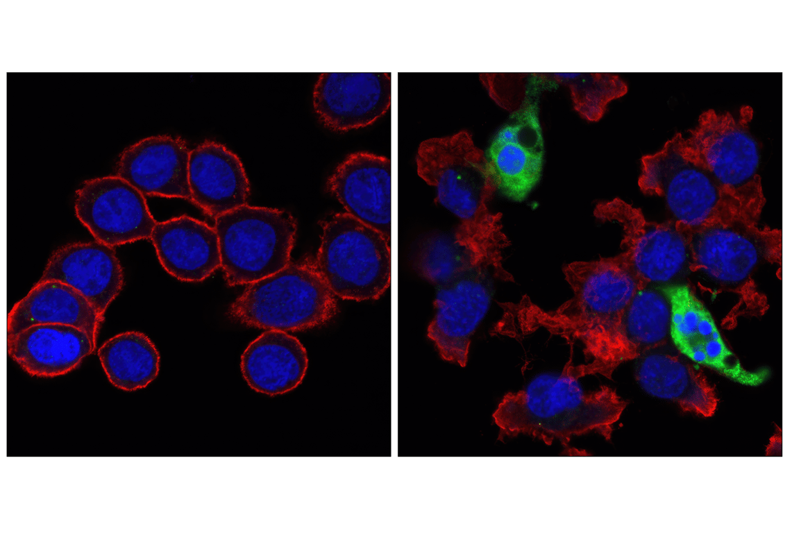 Immunofluorescence Image 1: Cleaved Caspase-3 (Asp175) (5A1E) Rabbit Monoclonal Antibody (BSA and Azide Free)