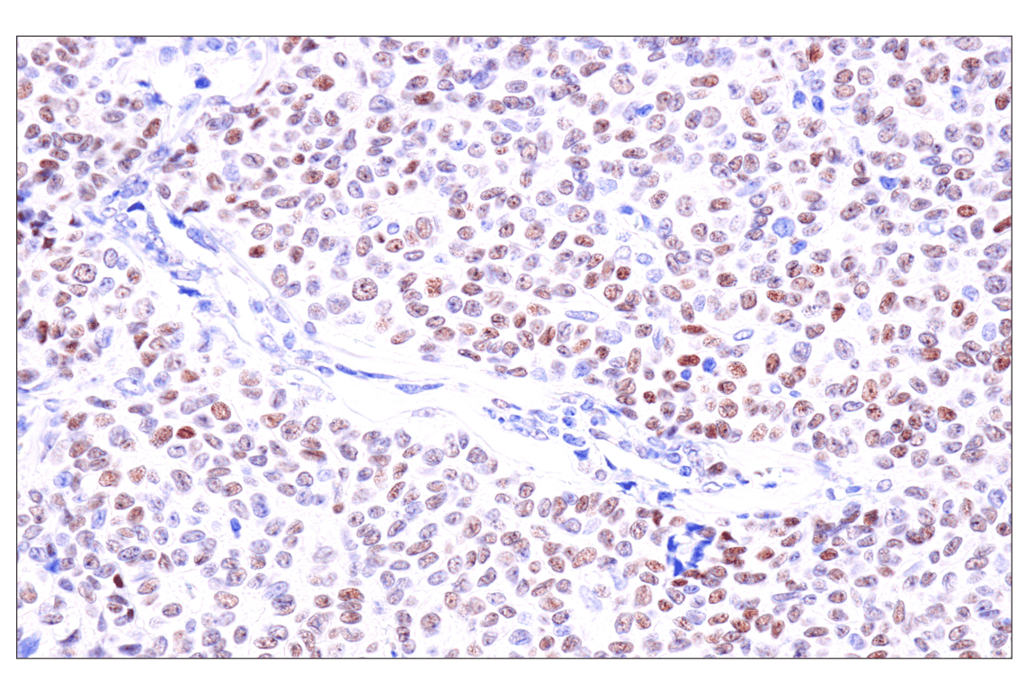 Immunohistochemistry Image 2: GATA-6 (D61E4) XP<sup>®</sup> Rabbit mAb