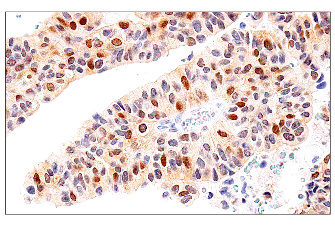 Immunohistochemistry Image 6: Chk1 (2G1D5) Mouse Monoclonal Antibody (BSA and Azide Free)